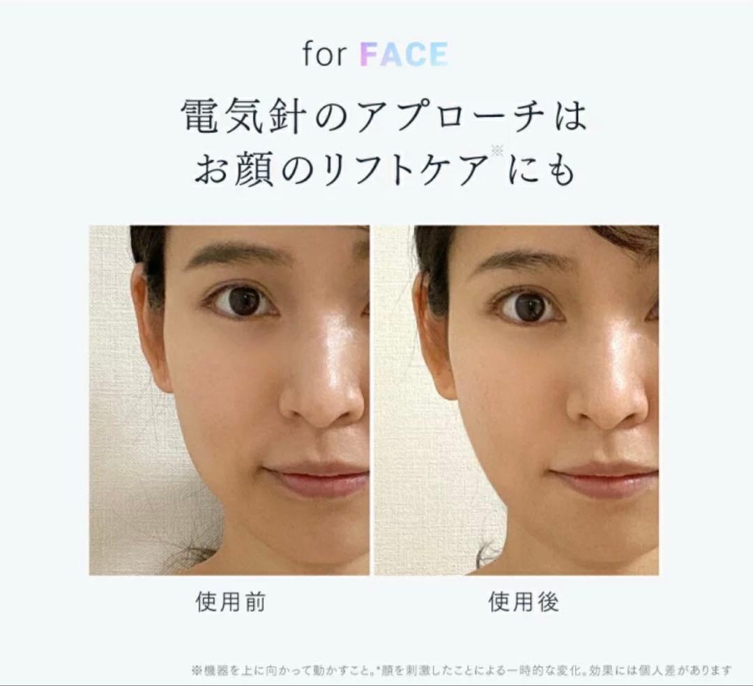 MYTREX EMS HEAD SPA PRO ブラック